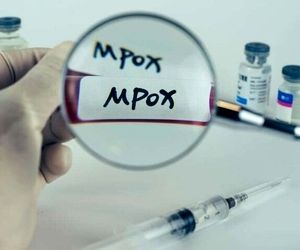 پاکستان چند فرودگاه را به دلیل شیوع ام‌پاکس ضدعفونی کرد