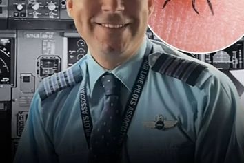 خلبان جت‌بلو اولین قربانی  آلرژی نادر کنه‌ها در جهان شد