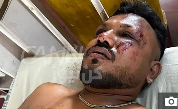 معجزه نجات! سقوط بویینگ ۷۸۷ ایرایندیا یک بازمانده داشت