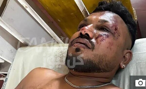 معجزه نجات! سقوط بویینگ ۷۸۷ ایرایندیا یک بازمانده داشت
